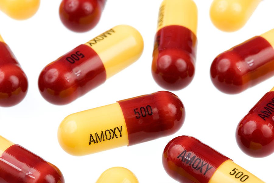 Amoxicillin là thuốc gì? Công dụng, liều dùng và chống chỉ định