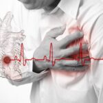 Các phương pháp và phác đồ điều trị suy tim