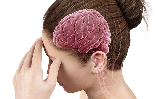 Các di chứng thường gặp sau tai biến mạch máu não