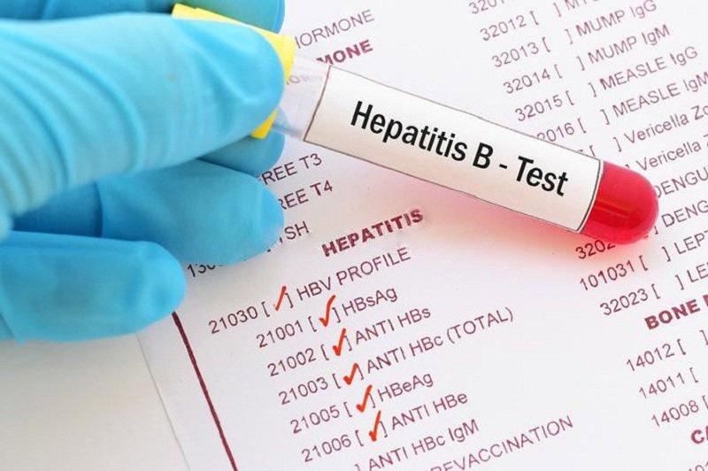 Kết quả HBsAg là Positive 10.99 có phải viêm gan B không?